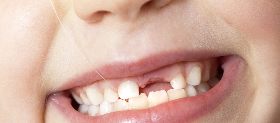 Zahnarzt Hamburg “Nix Aua!” in Altona